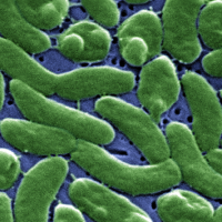 Microscopy: Vibrio Vulnificus, Image: Courtesy CDC.